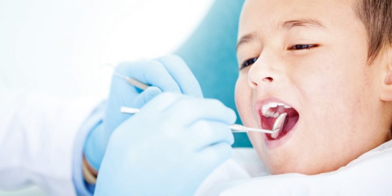Phòng ngừa sâu răng cho trẻ bằng những cách đơn giản nhất